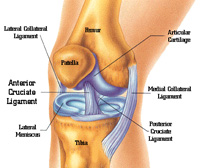 Женский коленный эндопротез - Zimmer Gender Knee